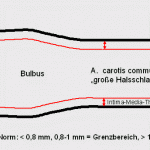 Messung der Intima-Media-Dicke